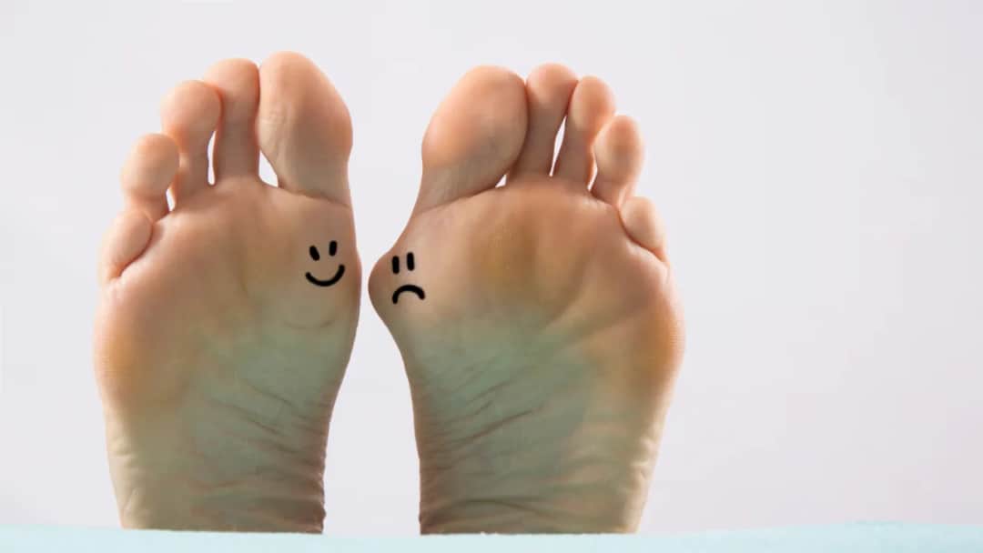 Ile trwa rehabilitacja po operacji haluksa? Poznaj kluczowe etapy